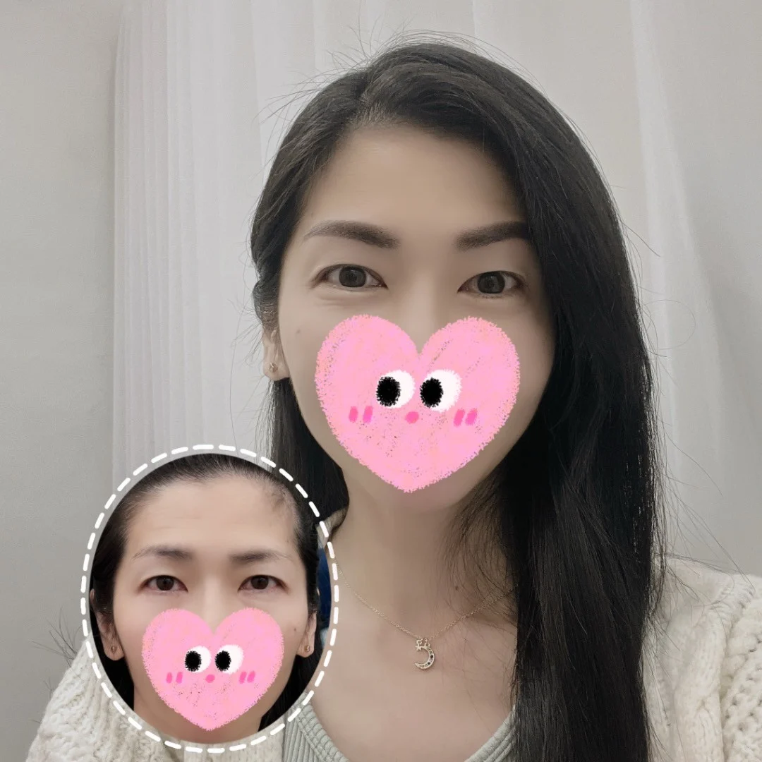 霧眉
